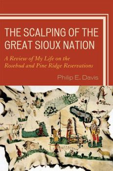 Paperback The Scalping of the Great Sioux Nation: A Review of My Life on the Rosebud and Pine Ridge Reservations Book