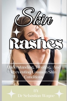 Paperback Skin Rashes: Understanding, Treating, And Preventing Skin Conditions Book