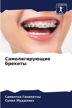 Paperback Самолигирующие брекеты [Russian] Book