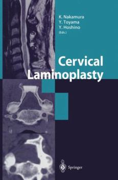 Hardcover Cervical Laminoplasty Book
