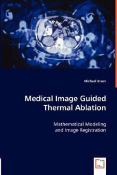 Paperback Medical Image Guided Thermal Ablation Book