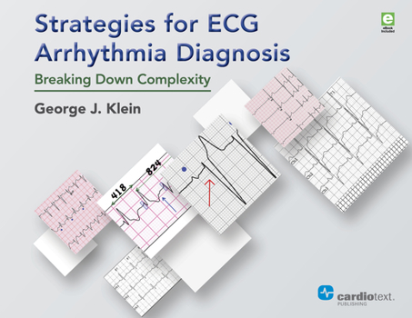 Paperback Strategies for ECG Arrhythmia Diagnosis: Breaking Down Complexity Book