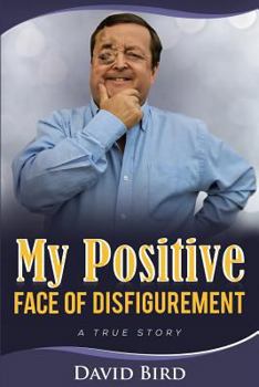 Paperback My Positive Face Of Disfigurement: A True Story Book