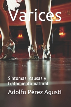 Paperback Varices: Síntomas, causas y tratamiento natural [Spanish] Book