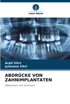 Paperback Abdrücke Von Zahnimplantaten [German] Book