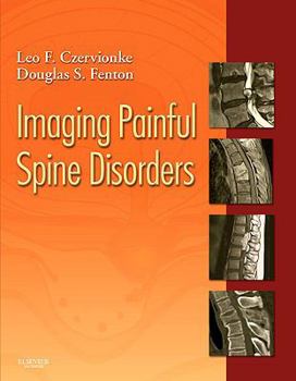 Hardcover Imaging Painful Spine Disorders [With Access Code] Book
