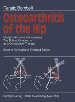 Hardcover Osteoarthritis of the Hip: Classification and Pathogenesis The Role of Osteotomy as a Consequent Therapy Book