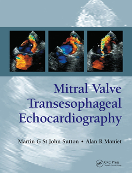 Paperback Mitral Valve Transesophageal Echocardiography Book