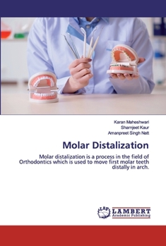 Paperback Molar Distalization Book