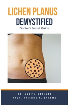 Paperback Lichen Planus Demystified Doctors Secret Guide Book