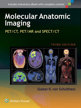 Hardcover Molecular Anatomic Imaging: Pet/Ct, Pet/MR and Spect CT Book