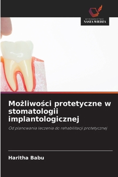 Paperback Możliwości protetyczne w stomatologii implantologicznej [Polish] Book