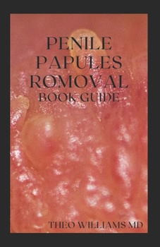 Paperback Penile Papules Romoval Book Guide: The Ultimate Guide On How To Remove Pearly Penile Papules Using Natural Remedies Book
