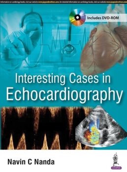 Paperback Interesting Cases in Echocardiography Book