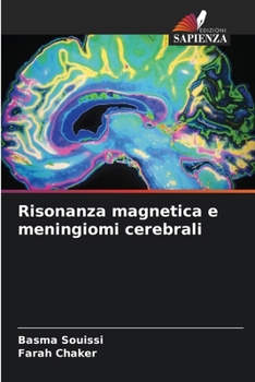 Paperback Risonanza magnetica e meningiomi cerebrali Book