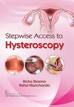 Paperback Stepwise Access to Hysteroscopy Book