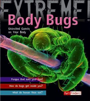 Library Binding Body Bugs!: Uninvited Guests on Your Body Book