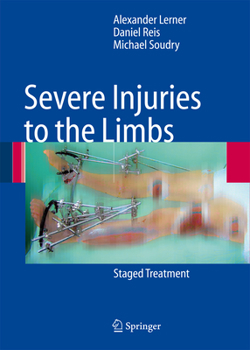 Paperback Severe Injuries to the Limbs: Staged Treatment Book