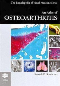 Hardcover An Atlas of Osteoarthritis Book