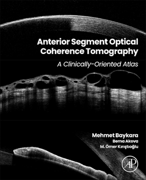 Paperback Anterior Segment Optical Coherence Tomography: A Clinically-Oriented Atlas Book