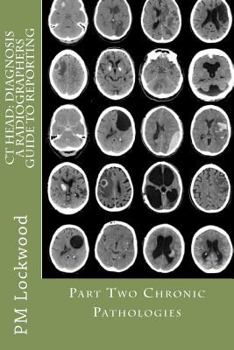 Paperback CT Head: DIAGNOSIS A Radiographers Guide To Reporting Part 2 Chronic Pathologies: Part 2 Chronic Pathologies Book