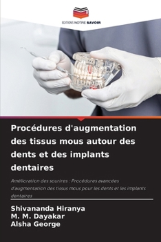 Paperback Procédures d'augmentation des tissus mous autour des dents et des implants dentaires [French] Book