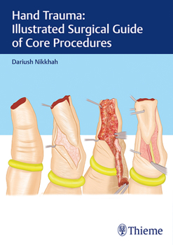 Hardcover Hand Trauma: Illustrated Surgical Guide of Core Procedures Book