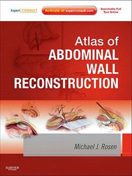 Hardcover Atlas of Abdominal Wall Reconstruction: Expert Consult - Online and Print Book