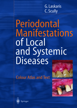 Paperback Periodontal Manifestations of Local and Systemic Diseases: Colour Atlas and Text Book