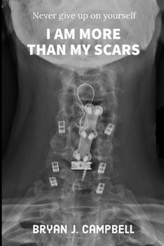 Paperback I Am More Than My Scars: Never Give Up On Yourself Book