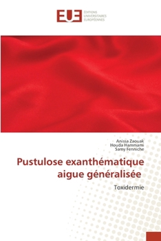 Pustulose exanthématique aigue généralisée (French Edition)