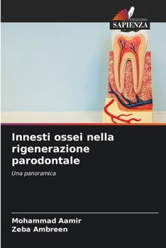 Paperback Innesti ossei nella rigenerazione parodontale [Italian] Book