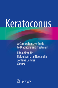 Paperback Keratoconus: A Comprehensive Guide to Diagnosis and Treatment Book