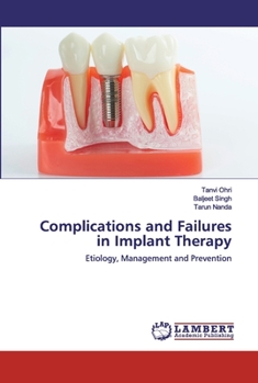 Paperback Complications and Failures in Implant Therapy Book