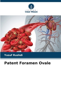 Paperback Patent Foramen Ovale [German] Book