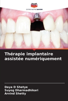 Paperback Thérapie implantaire assistée numériquement [French] Book