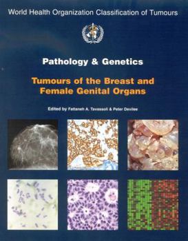 World Health Organization: Tumours of the Breast and Female Genital Organs (Who/IARC Classification of Tumours) (Who/IARC Classification of Tumours)