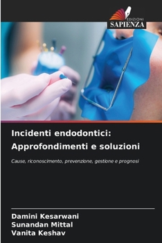 Paperback Incidenti endodontici: Approfondimenti e soluzioni [Italian] Book