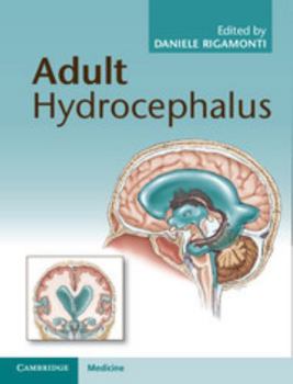 Hardcover Adult Hydrocephalus Book