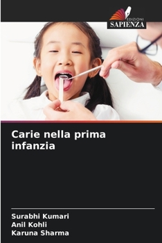 Paperback Carie nella prima infanzia [Italian] Book