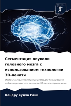 Сегментация опухоли головного мозга с использованием технологии 3D-печати: Извлечение трактов белого вещества для планирования нейрохирургического лечения и 3D-печати опухоли мозга