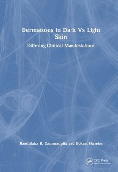 Hardcover Dermatoses in Dark Vs Light Skin: Differing Clinical Manifestations Book