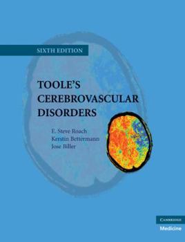 Hardcover Toole's Cerebrovascular Disorders Book