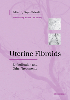 Paperback Uterine Fibroids: Embolization and Other Treatments Book