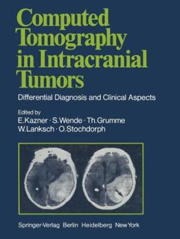 Paperback Computed Tomography in Intracranial Tumors: Differential Diagnosis and Clinical Aspects Book