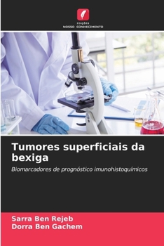 Paperback Tumores superficiais da bexiga [Portuguese] Book