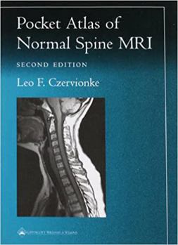 Paperback Pocket Atlas of Spinal MRI Book
