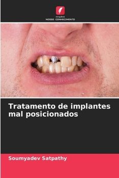 Paperback Tratamento de implantes mal posicionados [Portuguese] Book