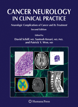Hardcover Cancer Neurology in Clinical Practice: Neurologic Complications of Cancer and Its Treatment Book