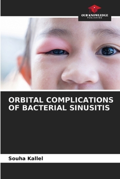 Paperback Orbital Complications of Bacterial Sinusitis Book